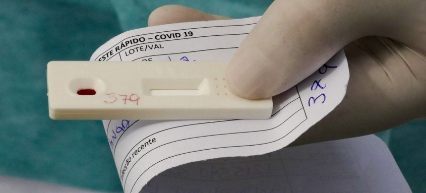 Número de infectados no país desde início da pandemia chega a 5.494.376 - Foto: Leopoldo Silva/Agência Senado Número de infectados no país desde início da pandemia chega a 5.494.376
