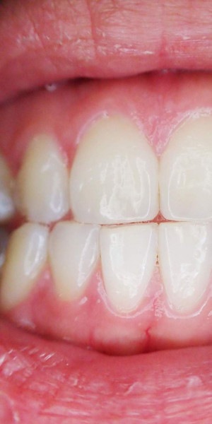 Muita gente não leva a sério, o que pode resultar na perda dos dentes e no desenvolvimento de doenças sistêmicas - Foto: Pixabay Muita gente não leva a sério, o que pode resultar na perda dos dentes e no desenvolvimento de doenças sistêmicas