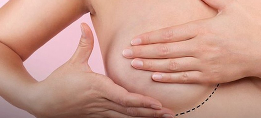A reconstrução da mama representa muito para a mulher, pelo impacto positivo em sua imagem e auto-estima