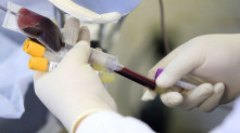Iniciativa tem o objetivo de aumentar o número de doadores a fim de regularizar os estoques de sangue e atender a todos que precisam Davidyson Damasceno/Divulgação