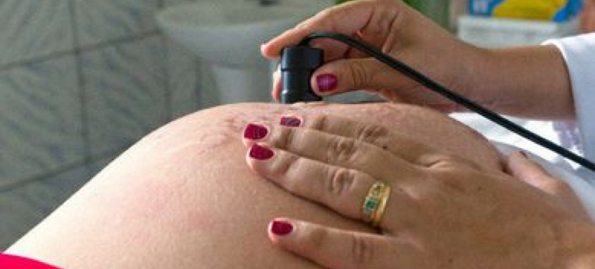 Dados usados são de óbitos pela doença registrados em 2020 e 2021
