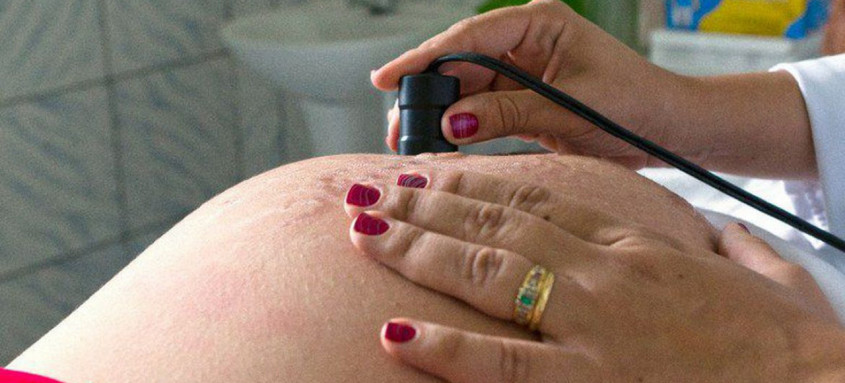 Estudo analisa dados referentes a 60 mil mulheres de 2004 a 2018
- Foto: Ministério da Saúde/Divulgação Estudo analisa dados referentes a 60 mil mulheres de 2004 a 2018