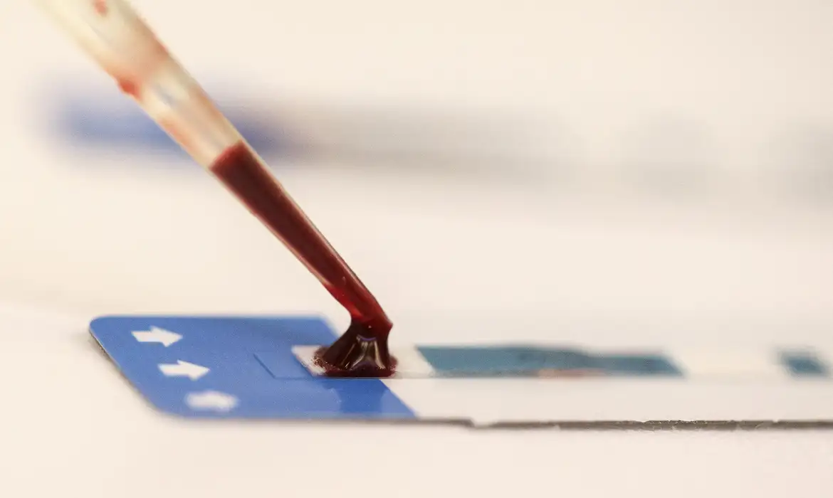O HIV é um vírus que afeta o sistema imunológico. A contaminação ocorre na maioria das vezes através do contato sexual desprotegido - Foto: Tomaz Silva/Agência Brasil O HIV é um vírus que afeta o sistema imunológico. A contaminação ocorre na maioria das vezes através do contato sexual desprotegido