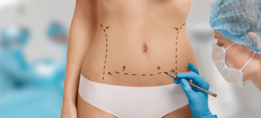 Entre os fatores essenciais para o sucesso da lipoaspiração estão a realização em ambiente habilitado e liberado pelos órgãos de vigilância sanitária, com estrutura hospitalar - Foto: Freepik Entre os fatores essenciais para o sucesso da lipoaspiração estão a realização em ambiente habilitado e liberado pelos órgãos de vigilância sanitária, com estrutura hospitalar